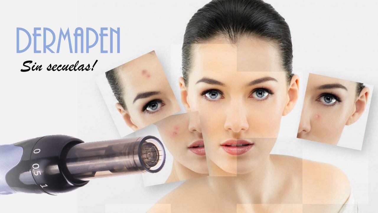 dermapen-secuelas-de-acne-le-blanc.jpg
